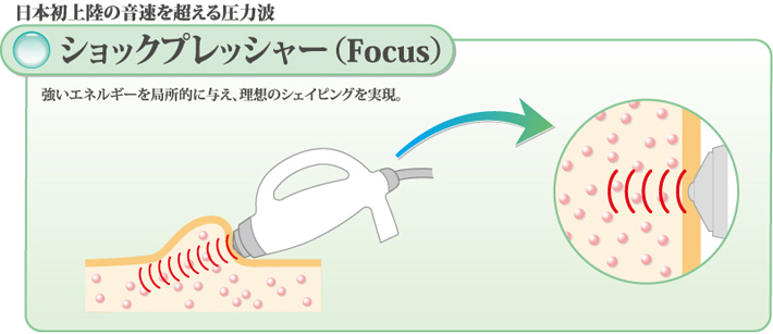 ショックプレッシャー